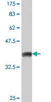 Anti-TGIF2 Mouse Polyclonal Antibody (50µl) - High-Quality Research Antibody for Western Blot, Immunohistochemistry & ELISA Testing