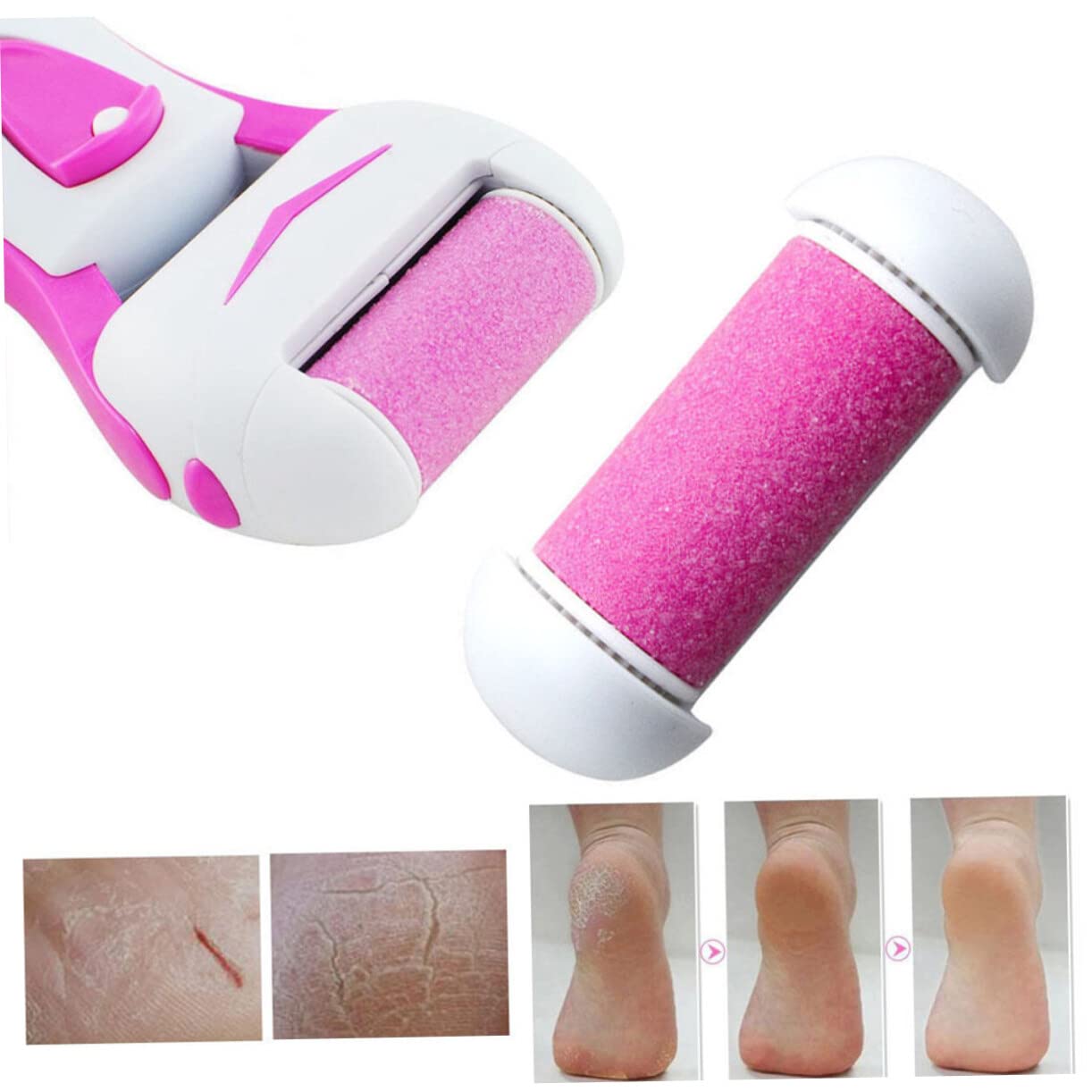PLAFOPE Electric Whisking Tool Replacement Roller Foot - Compatible with Power Tools & Electrical Tools Accessories - Perfect for Baking, Mixing & DIY Projects