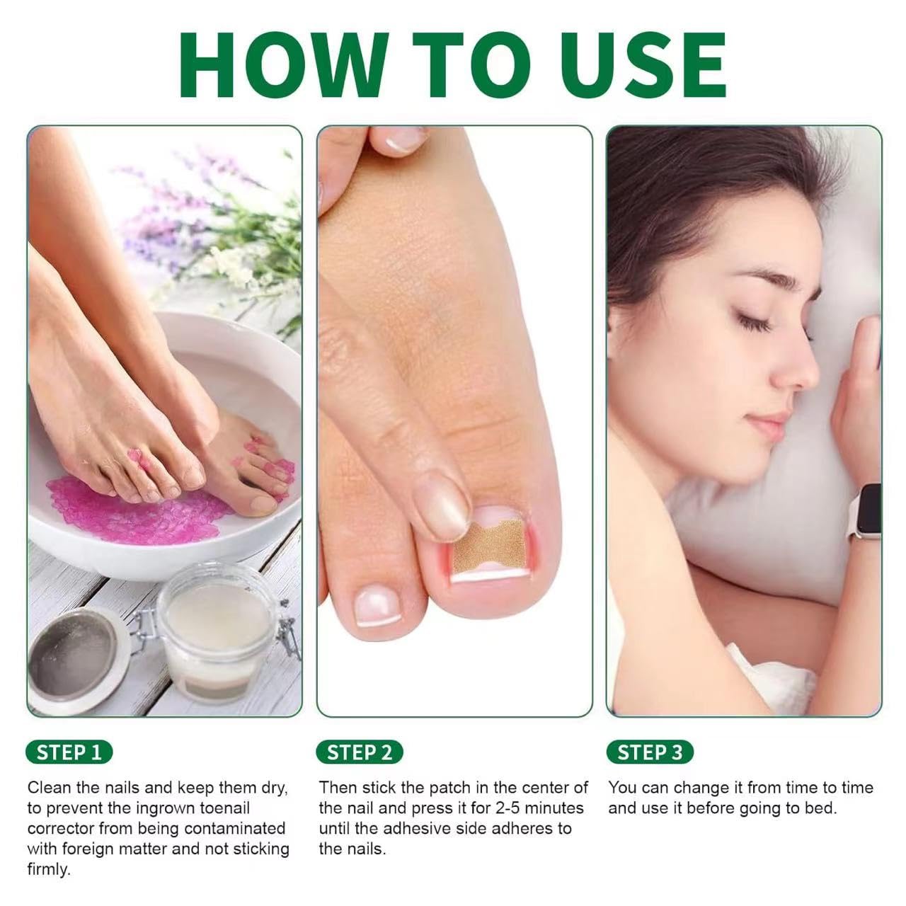 50 Pcs Ingrown Toenail Corrector Patches - No Glue Breathable & Painless Nail Correction Treatment - Stays Secured for Quick Repair | Perfect for Athletes, Runners & Daily Comfort