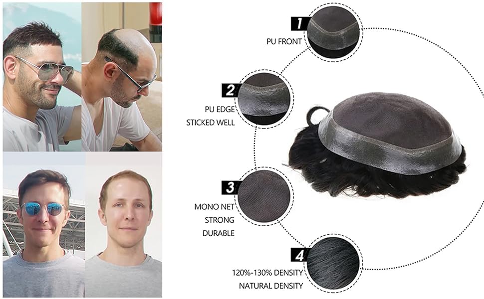 Premium Australian Hair Patch for Men – Non-Surgical Hair Loss Solution | Durable Toupee Hair System with Glue, Clips & Tape | 9x7 Inches Natural Brown | Perfect for Daily Wear, Work & Social Events
