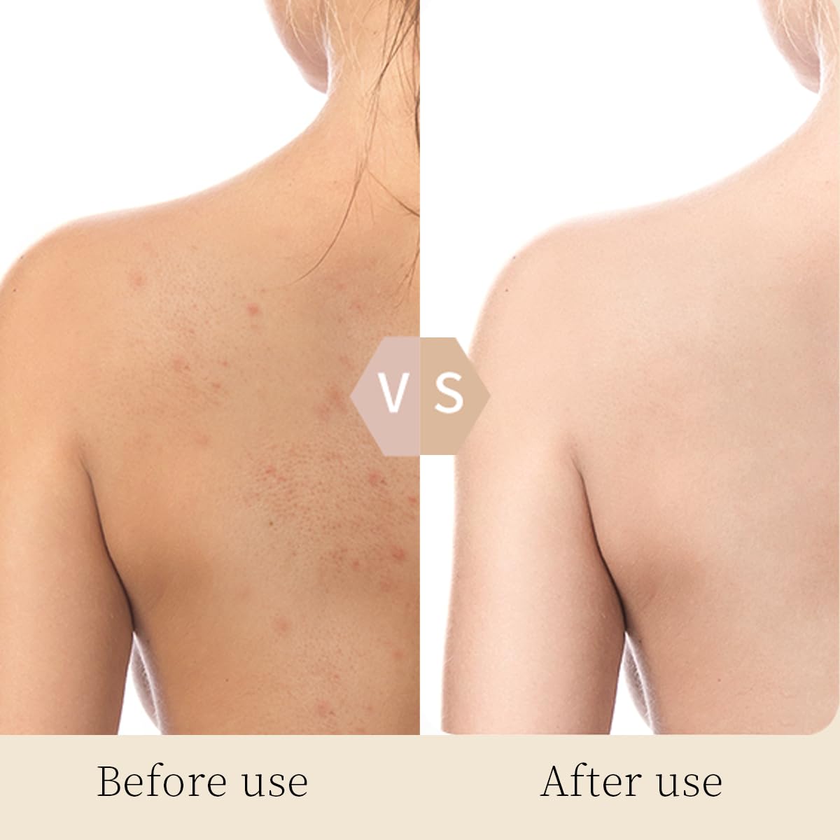 Exfoliating Fruit Acid Body Wash for Smooth & Glowing Skin - Perfect for Daily Use & Acne-Prone Skin