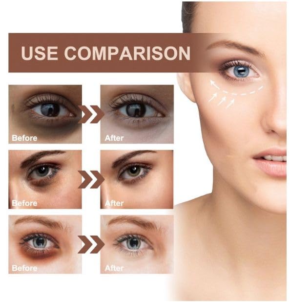 YELURI Dark Circle Eye Serum - Brightening & Anti-Aging Eye Treatment for Puffiness & Wrinkles (30ml) | Day & Night Use for Tired Eyes | Cruelty-Free Skincare