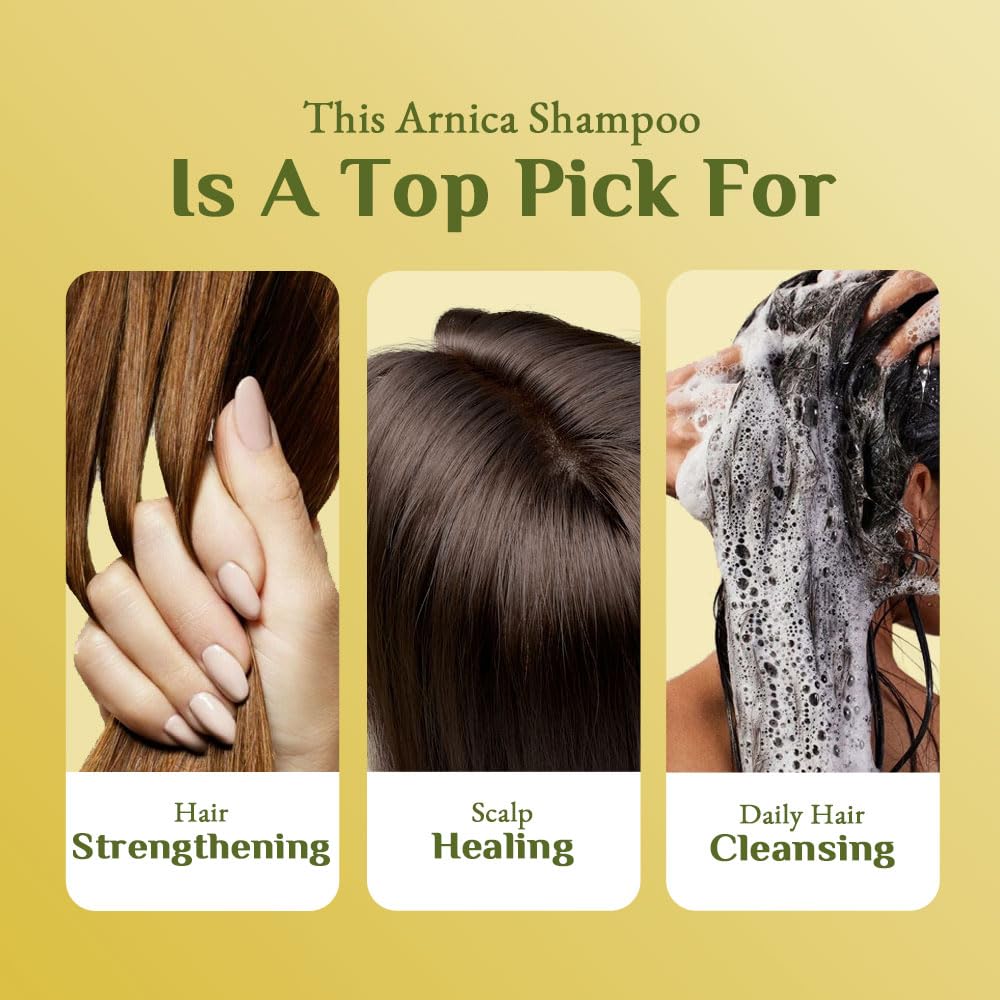Richfeel Arnica Anti Dandruff Shampoo - 100ml | Eliminates Dandruff Flakes, Controls Excess Oil & Relieves Scalp Itching | For Daily Hair Care & Scalp Health