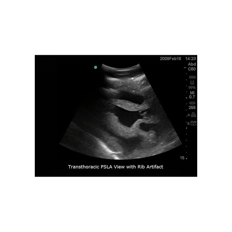 FAST Exam Ultrasound Training Model - Transthoracic & Transesophageal Echo Simulator for Cardiac Sonography Practice (Ideal for Medical Students, Ultrasound Tech Training & Clinical Skills Development)