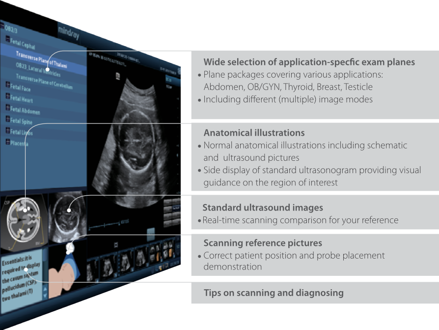 Mindray DC-70 Full HD Ultrasound System - Professional Diagnostic Imaging for Hospitals, Clinics & Veterinary Use