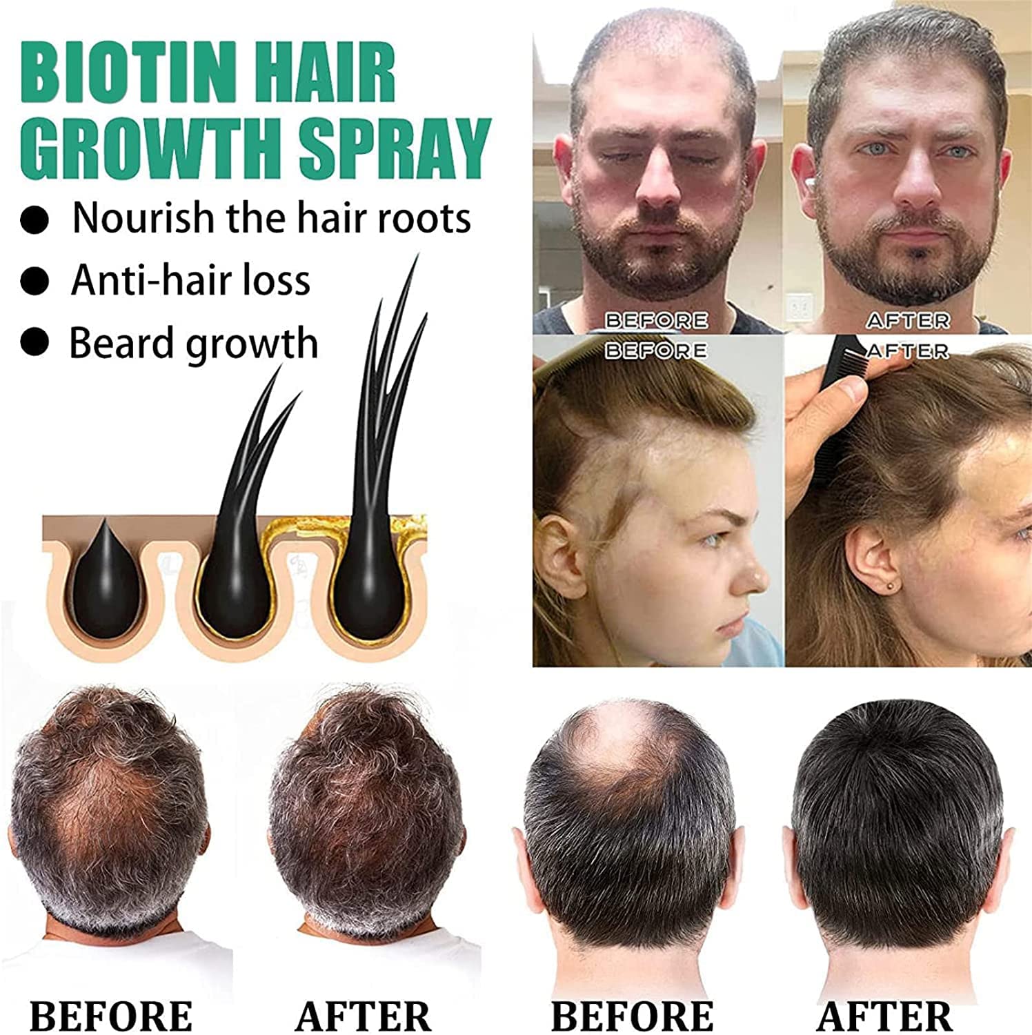 Re'Awaken Biotin Hair Growth Serum & Beard Spray - Hair Loss Treatment for Women & Men | Reduces Hair Loss, Promotes Regrowth & Restores Thinning Hair (3 Pack) | Perfect for Daily Hair Care Routine & Styling