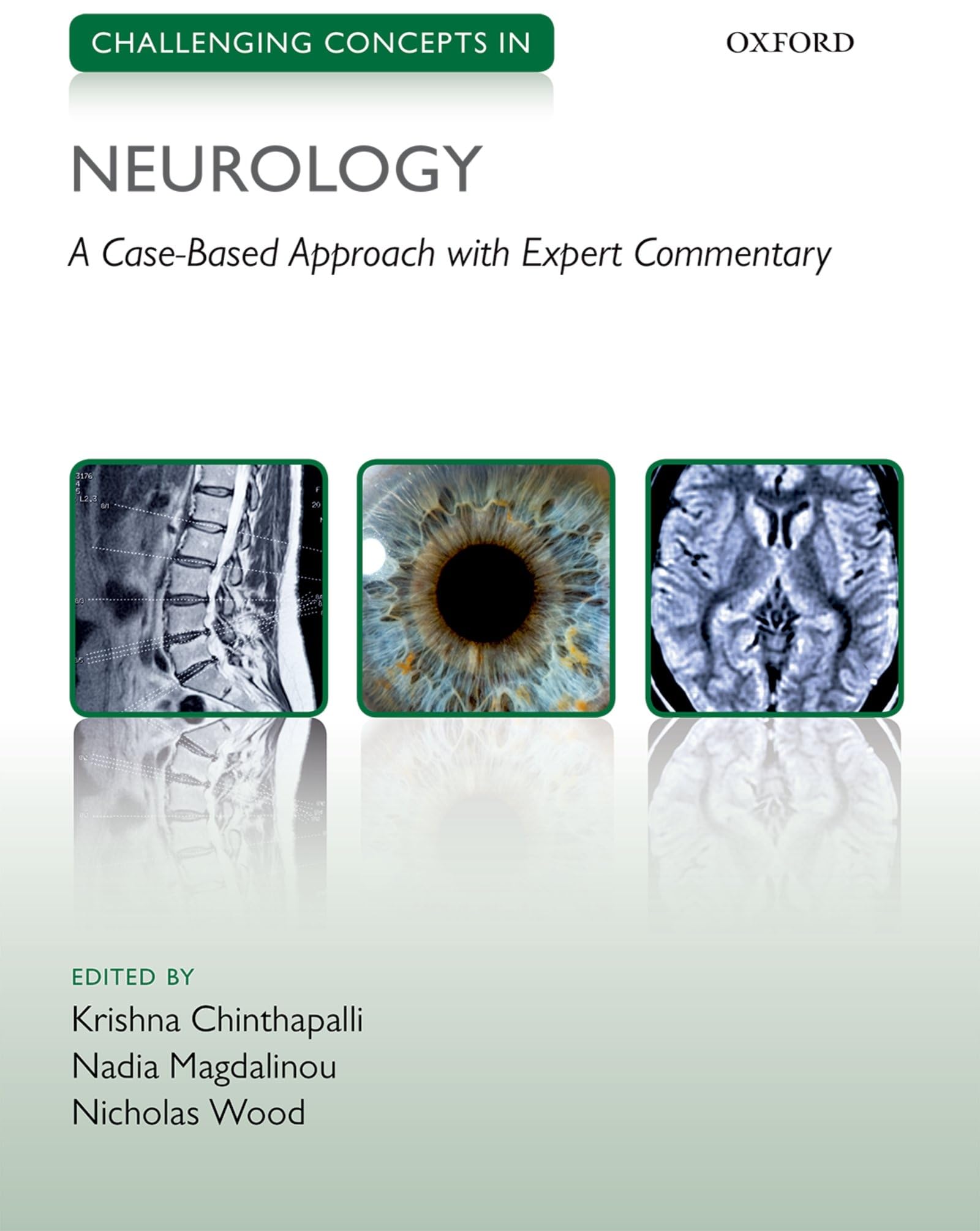 Challenging Concepts in Neurology: Expert Case Studies & Analysis - Perfect for Medical Students & Neurology Professionals