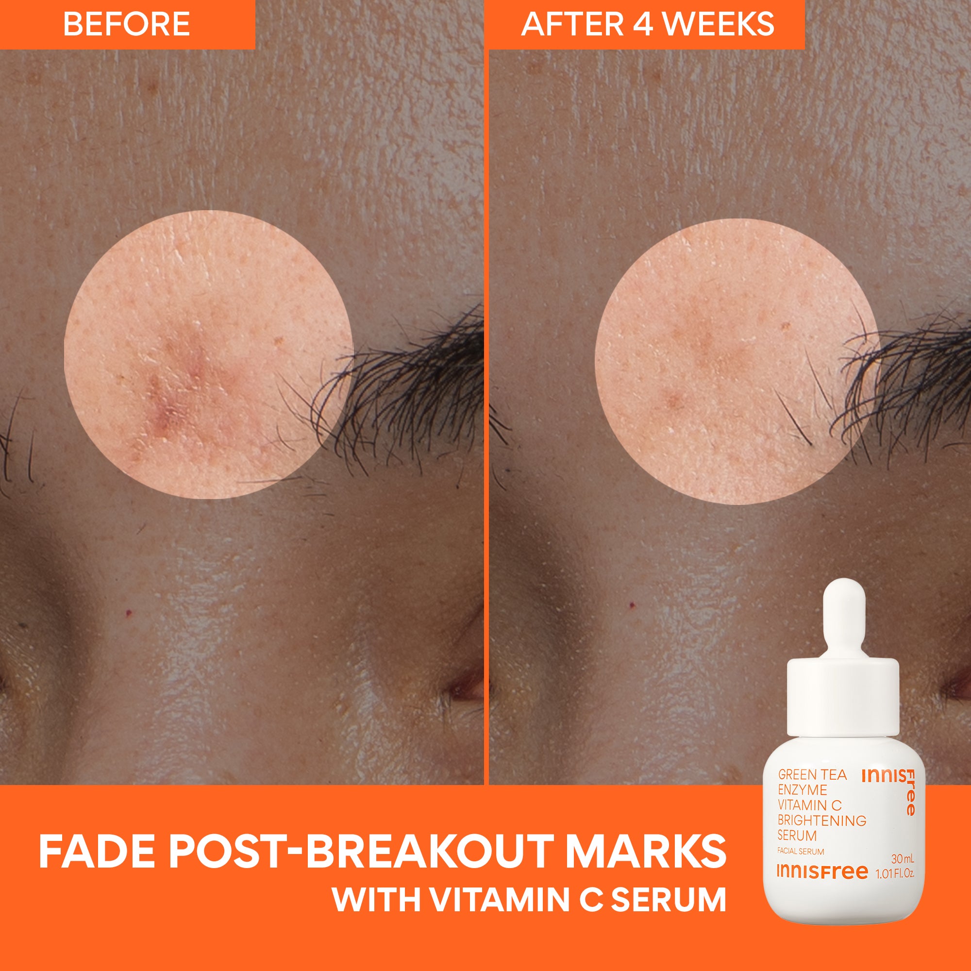 Brighten + Protect Skin Serum - Vitamin C & Hyaluronic Acid for Glowing, Hydrated Skin | Day & Night Use for All Skin Types | Perfect for Anti-Aging & Dark Spot Treatment