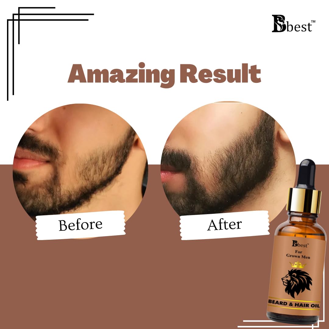 BBEST Premium Hair Growth Oil & Beard Oil for Men - 2 in 1 Professional Treatment with Natural Ingredients - 30ml Bottle - Perfect for Daily Hydration, Styling & Grooming Routine