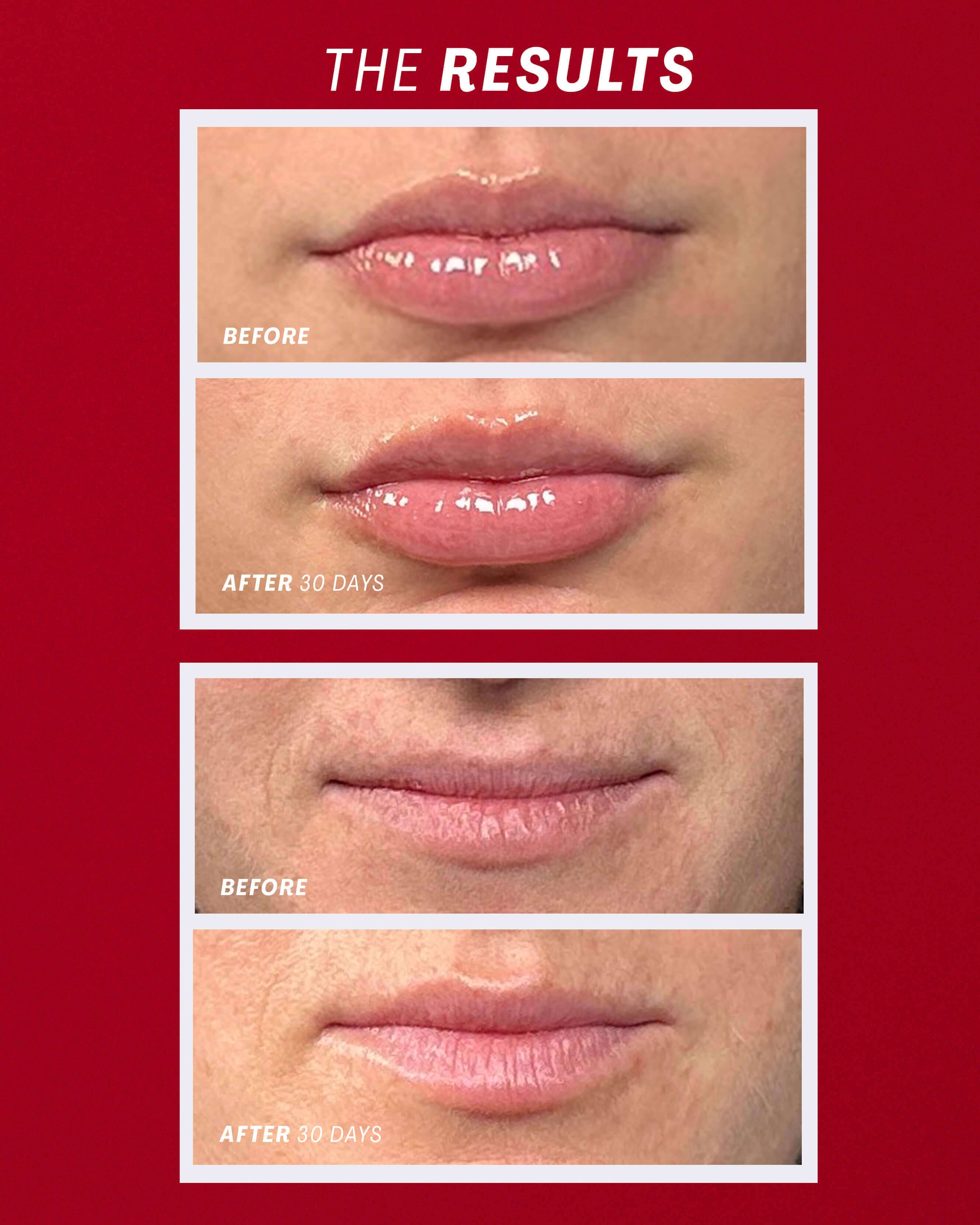Lip Oasis™️ Glossy Treatment - Hydrating Lip Gloss with Vitamin E & Shea Butter | Perfect for Dry Lips, Makeup Looks & Everyday Moisture