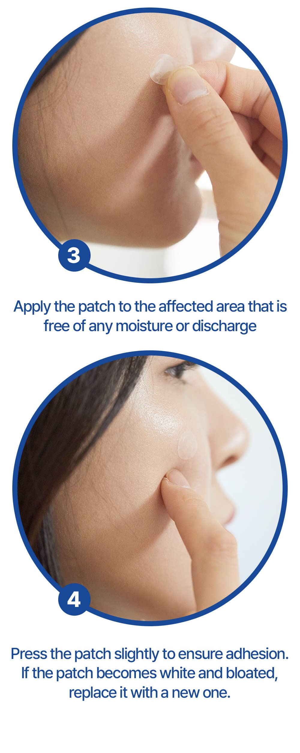 Oldam Hydrocolloid Acne Pimple Patches - 63 Count Vegan Spot Treatment Stickers for Face, Blemishes & Zits | Cruelty-Free Acne Cover for Overnight Healing & Daytime Wear