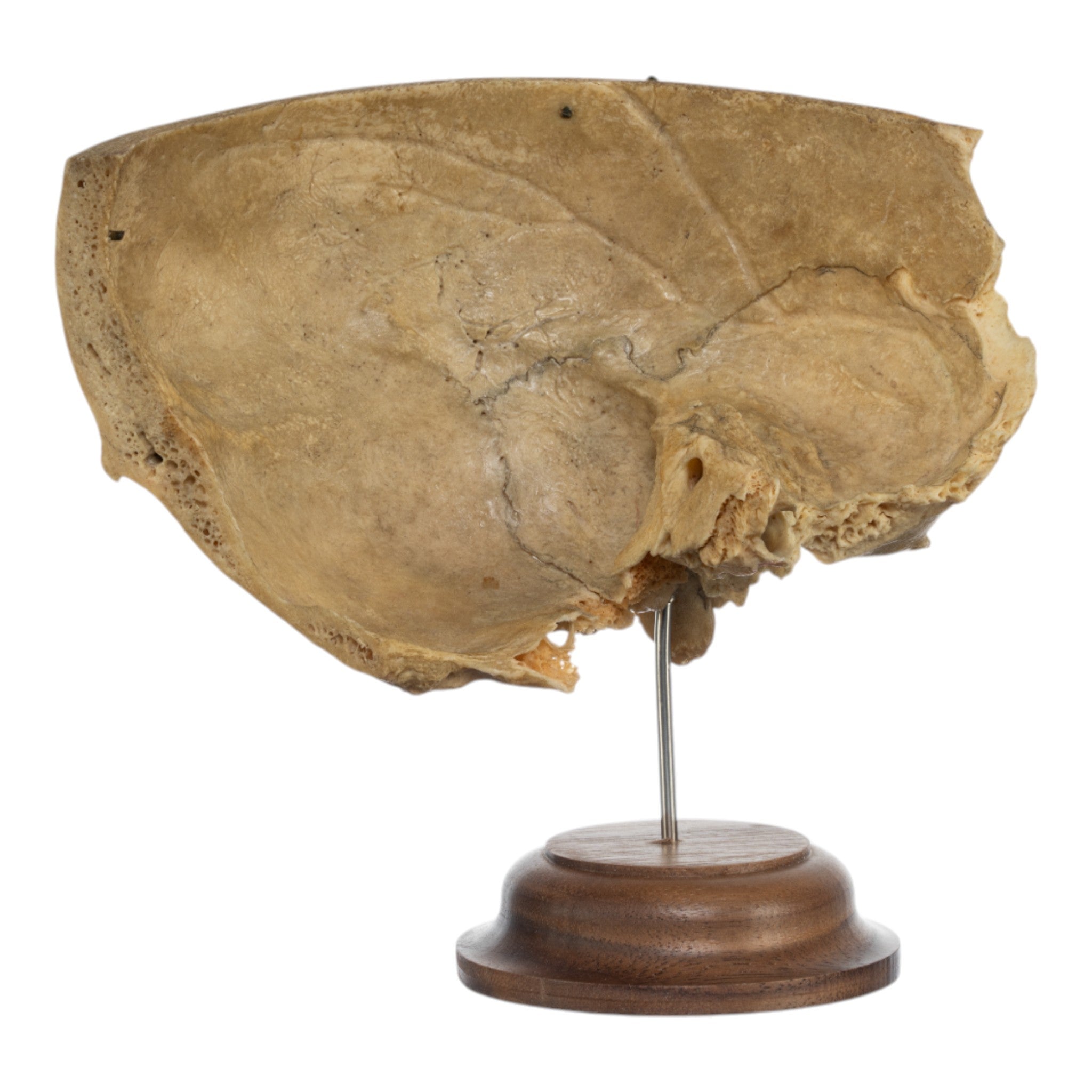 Real Human Partial Skull on Stand - Anatomical Model for Medical Study, Halloween Decor & Gothic Display - Perfect for Doctors, Students & Horror Enthusiasts