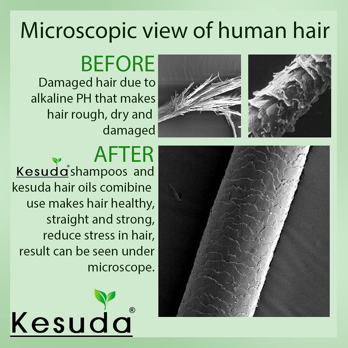 KESUDA Premium Amla Hair Oil 200ml - Natural Hair Growth Treatment for Dry, Damaged Hair - Use for Scalp Massage, Split Ends Repair & Daily Hair Care