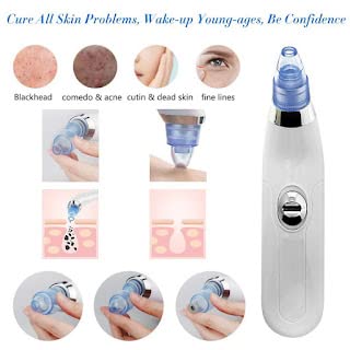 NL TRADERS Professional Acne Pore Cleaner Vacuum - Blackhead & Whitehead Remover Kit for Clear Skin | Derma Suction Tool for Pimple & Acne Treatment | Skin Care Device for Face Cleansing & Blemish Removal (White) | Perfect for Home Spa & Daily Skincare Routine