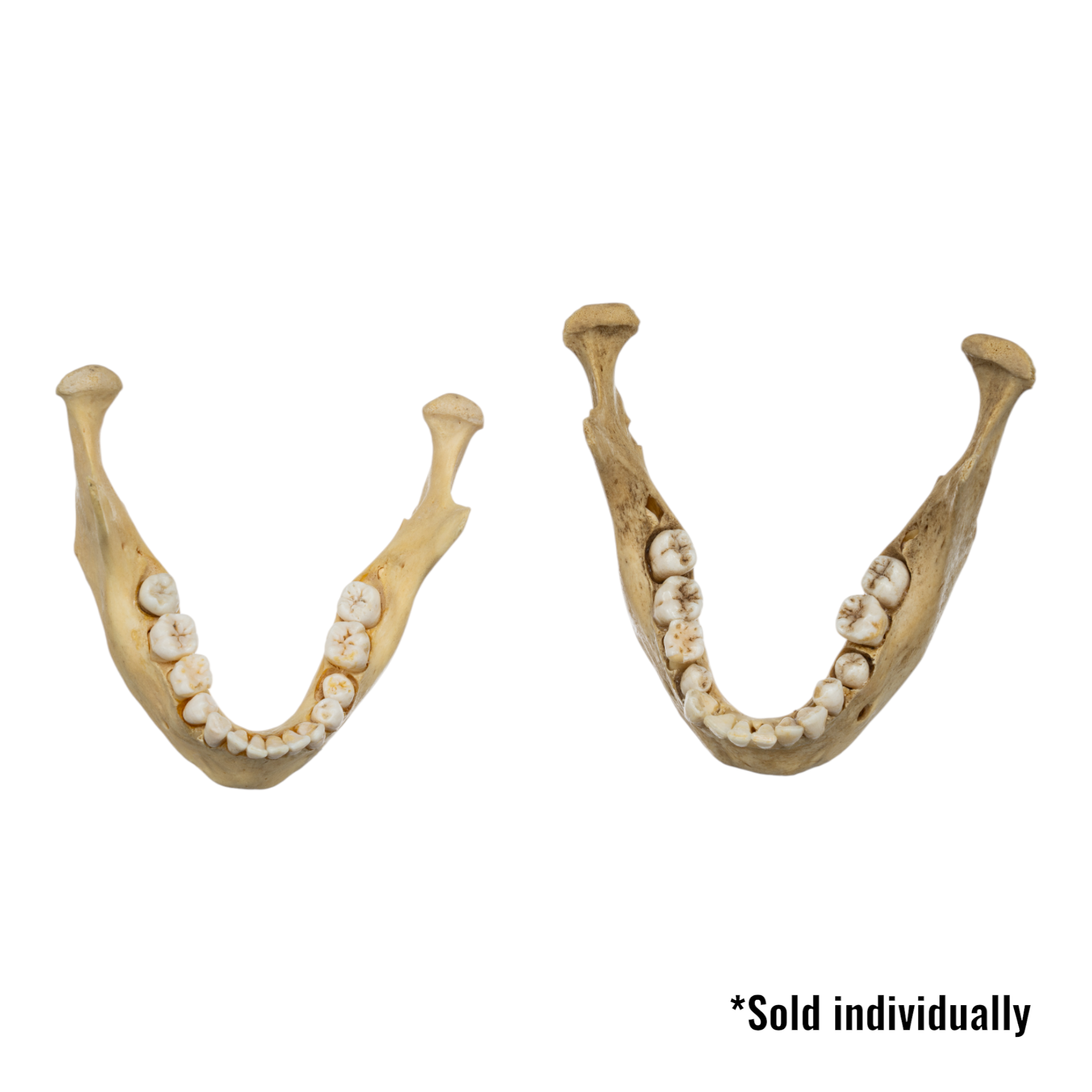 Authentic Real Human Mandible Bone - Young Adult Single Jawbone Specimen for Medical Study, Anatomy Education & Forensic Research