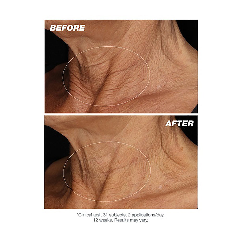 Dermalogica Neck Fit Contour Serum - Anti-Aging Neck Firming Treatment for Wrinkles & Sagging Skin | Daily Skincare Routine for Women & Men