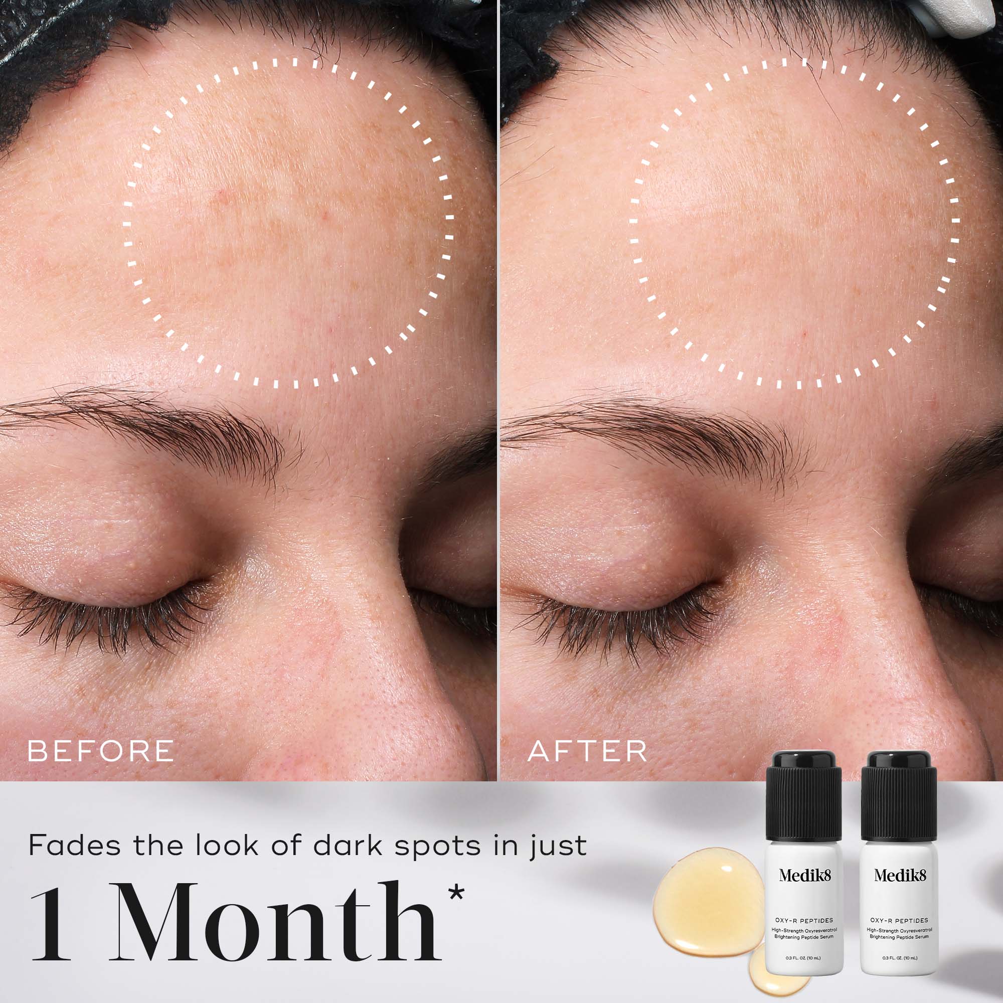 Oxy R Peptides - Premium Anti-Aging & Skin Rejuvenation Serum for Face & Neck | Reduce Wrinkles & Fine Lines | Perfect for Nighttime Skincare Routine & Daily Moisturizing