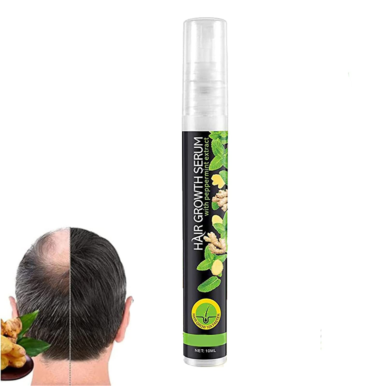 Natural Herbal Hair Growth Essence Spray - Fast Hair Regrowth Serum for Thicker Hair, Prevent Postpartum Hair Loss & Receding Hairline | Ideal for Daily Hair Care & Post-Pregnancy Recovery (1PC)