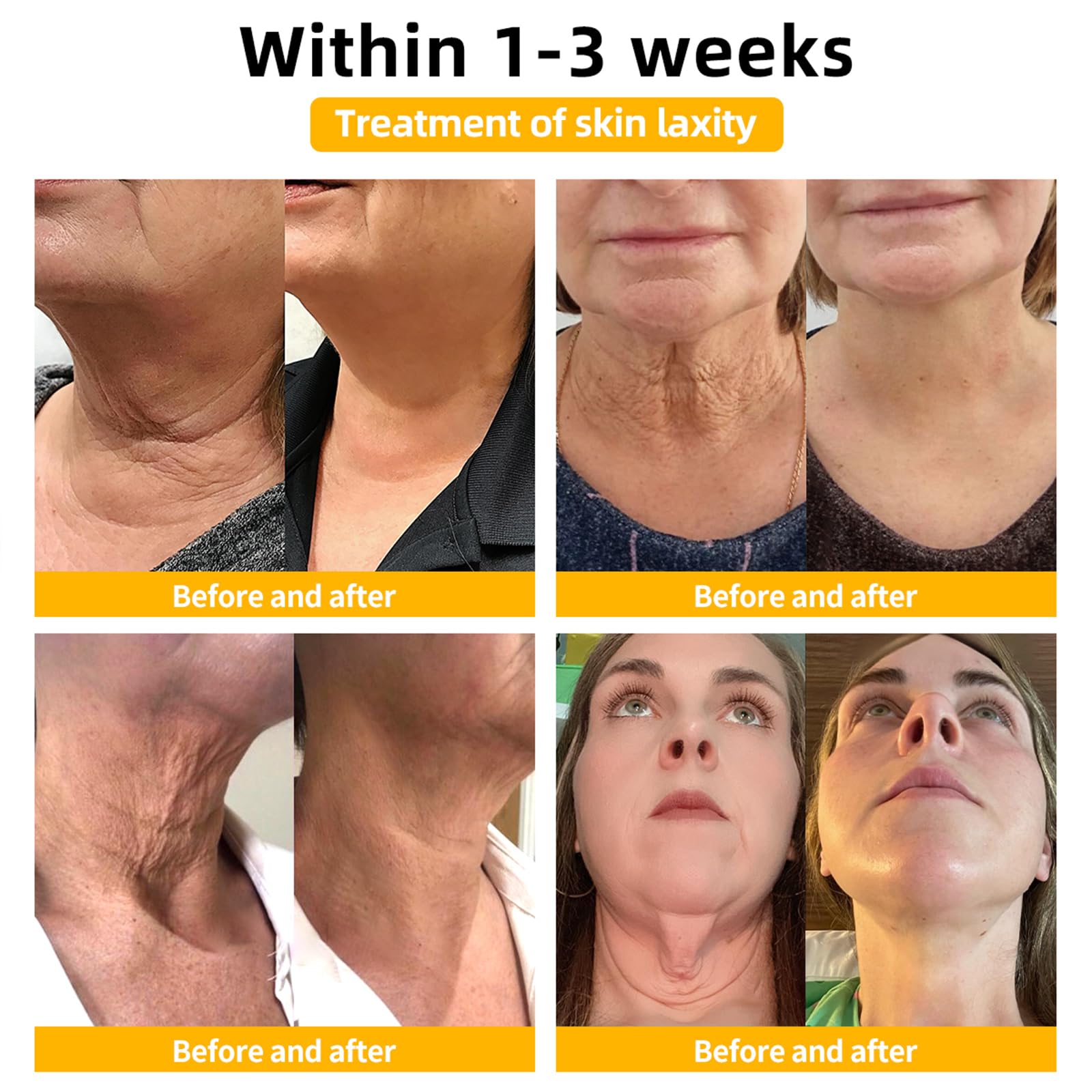 Fivfivgo Ultra Firming & Revitalizing Cream - Advanced Anti-Aging Skin Tightening Moisturizer for Face & Body, Renews Skin Elasticity, All Skin Types (60ml) - Perfect for Night Routine & Daily Hydration