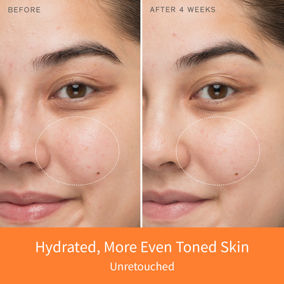 First Care Activating Serum VI - Hydrating & Anti-Aging Face Serum for Glowing Skin | Day & Night Skincare Routine | Perfect for Dry, Sensitive & Mature Skin Types