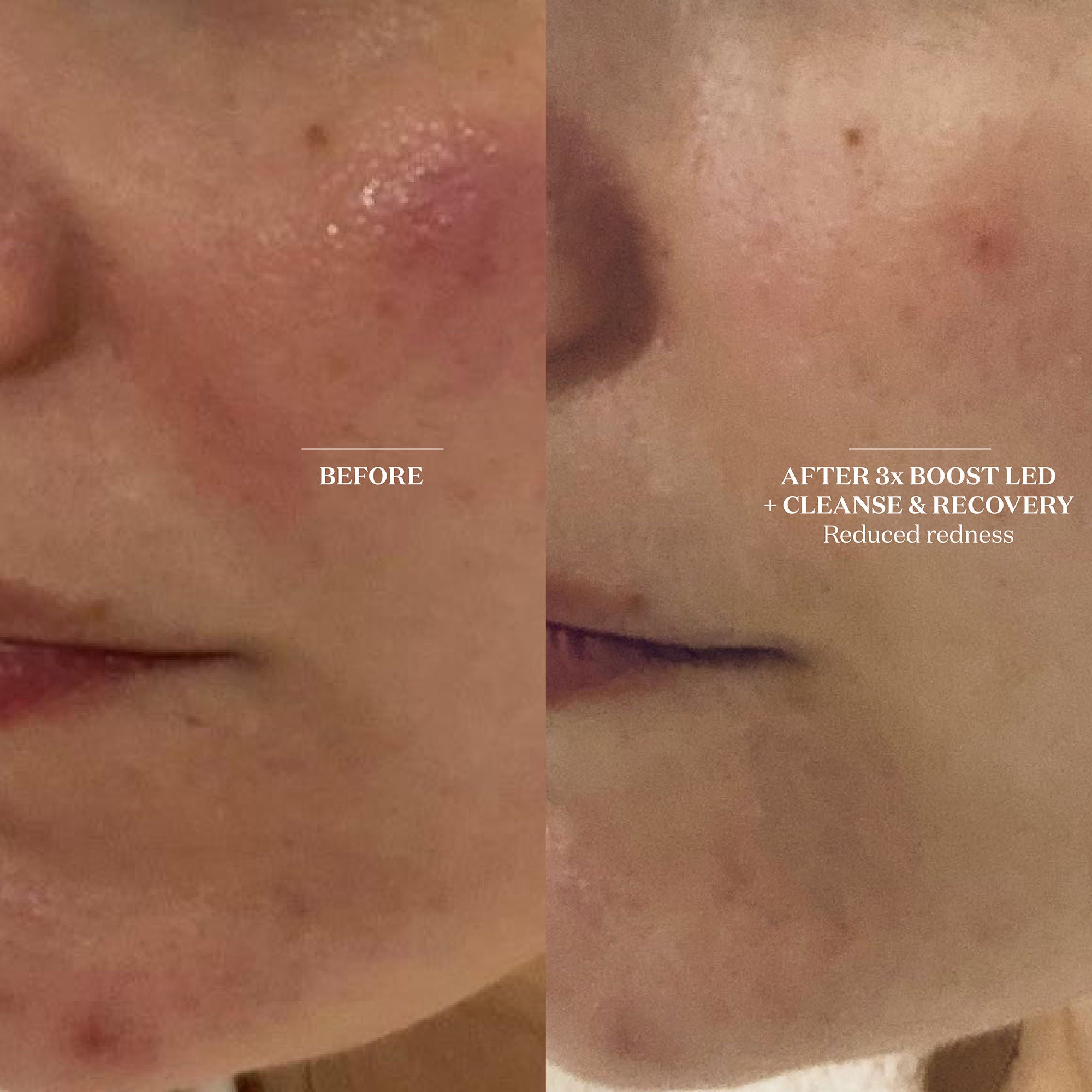 Cleanse & Recovery Spray - Detoxifying Facial Mist for Skin Refresh & Hydration | Perfect for Post-Workout, Travel & Daily Skincare Routine