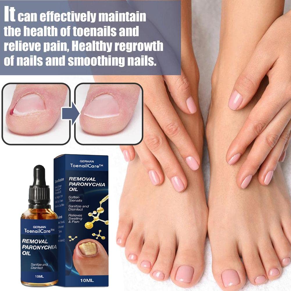 Toenail Care Removal Oil - Paronychia & Ingrown Toenail Treatment | Nail Renewal Liquid for Damaged & Discolored Nails | Fast Healing Solution for Healthy Feet | Perfect for Pedicures & Daily Foot Care