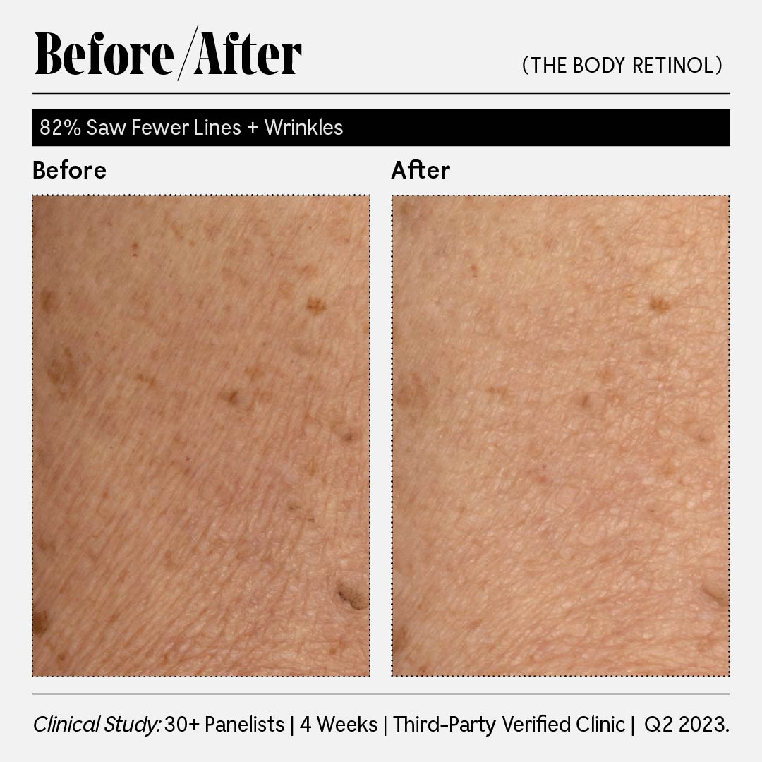 Best Retinol Cream for Face - Anti-Aging Moisturizer with Vitamin A - Reduce Wrinkles & Fine Lines - Night Cream for Women & Men - Perfect for Dry, Sensitive Skin & Daily Skincare Routine
