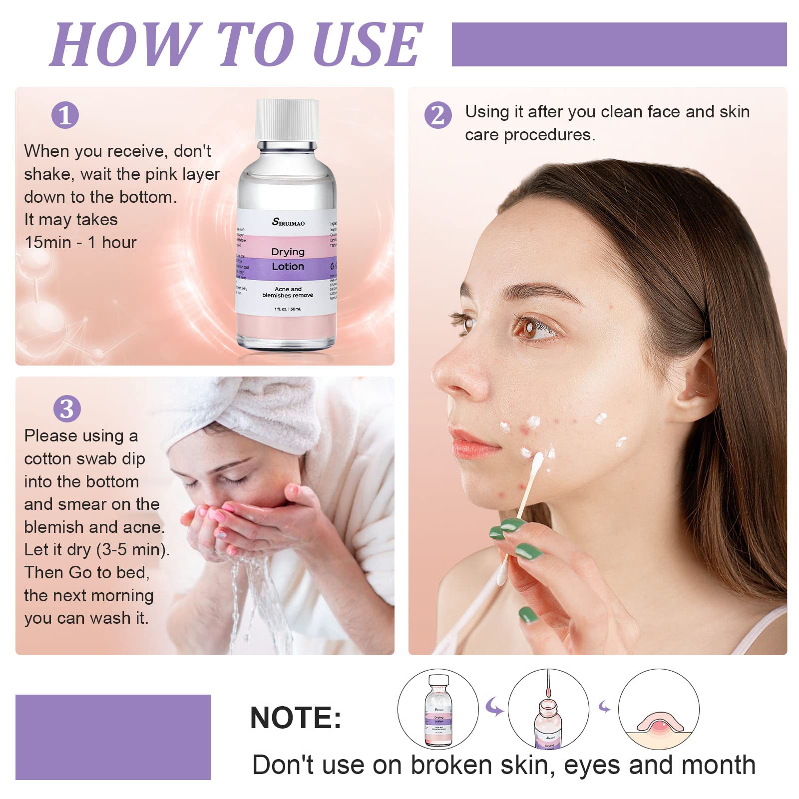 Stubborn Acne Drying Lotion (1OZ) - Overnight Acne Spot Treatment with Salicylic Acid for Face & Body | Fast-Acting Pimple Lotion to Dry Out Blemishes, Zits & Unclog Pores | Perfect for Teen & Adult Acne Care, Travel-Friendly Skincare Solution