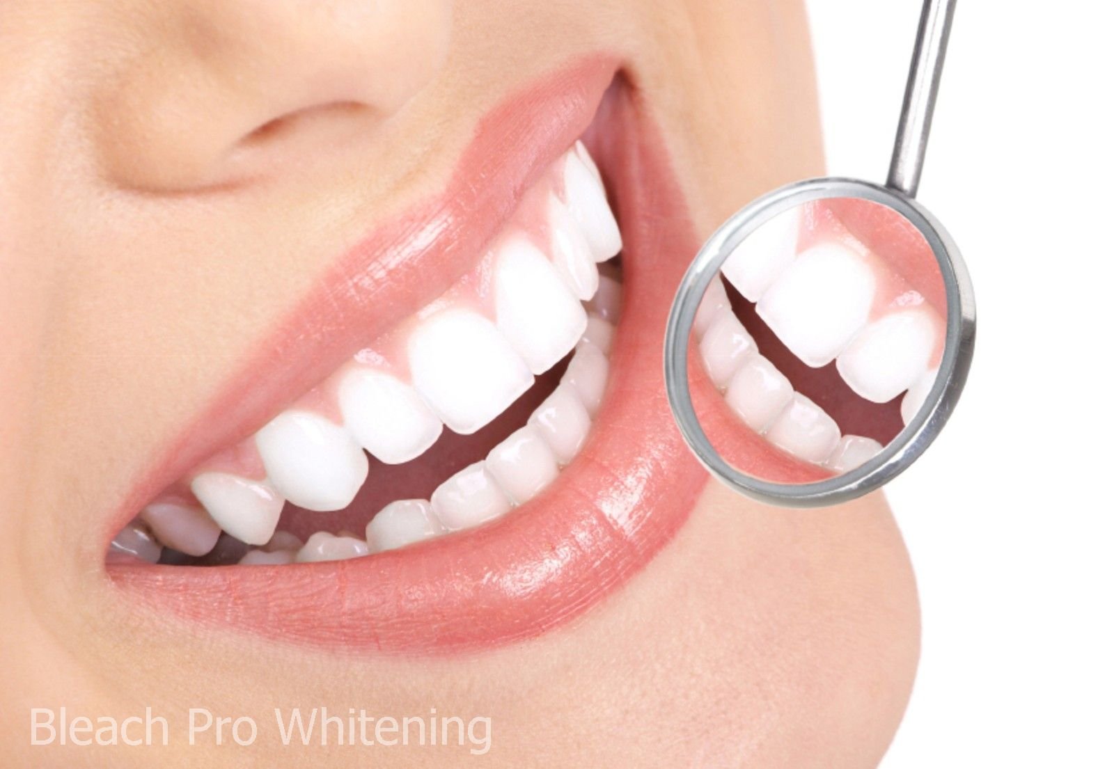 Professional Teeth Whitening Gel with 35% Carbamide Peroxide - Dental Bleaching Syringe Kit (40ml, 4 Pcs) for Brighter Smile at Home | Perfect for Sensitive Teeth & Coffee/Tea Stains Removal