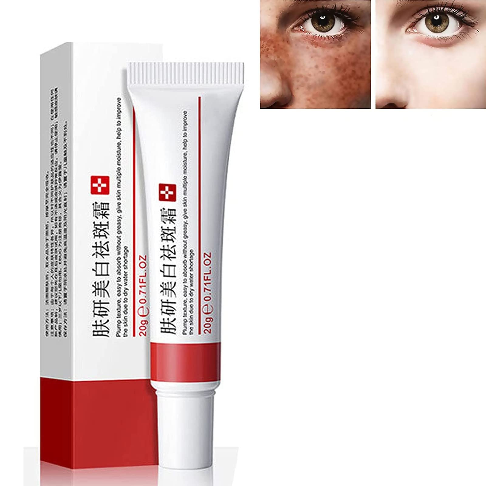 Freckle Whitening Cream & Acne Scar Removal Treatment - Brightening Pigment Spot Corrector for Melasma & Dark Spots (2 Pack) | Effective Skin Lightening Solution for Face & Body | Perfect for Daily Skincare Routine & Post-Acne Care