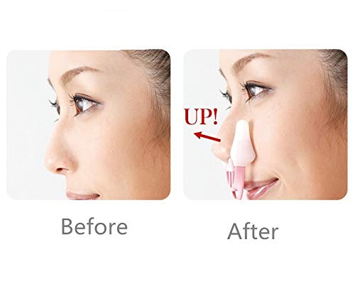 AlexVyan 2 Pack Nose Up Clip Set - Nose Shaping & Lifting Tool for Bridge Straightening, High Lift Correction, and Beauty Enhancement | Perfect for Daily Nose Reshaping, Makeup Application, and Non-Surgical Nose Job Alternative