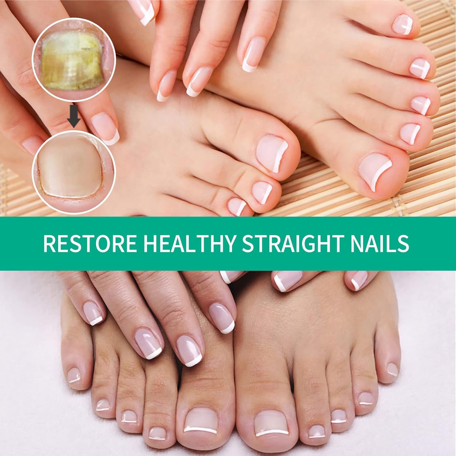 Extra Strength Toenail Fungus Treatment for Toenail & Fingernail - Fast-Acting Nail Repair Solution, Renewal Liquid for Damaged & Discolored Nails - Cool Blue (2 Pack) - Perfect for Athletes, Swimmers & Salon Professionals