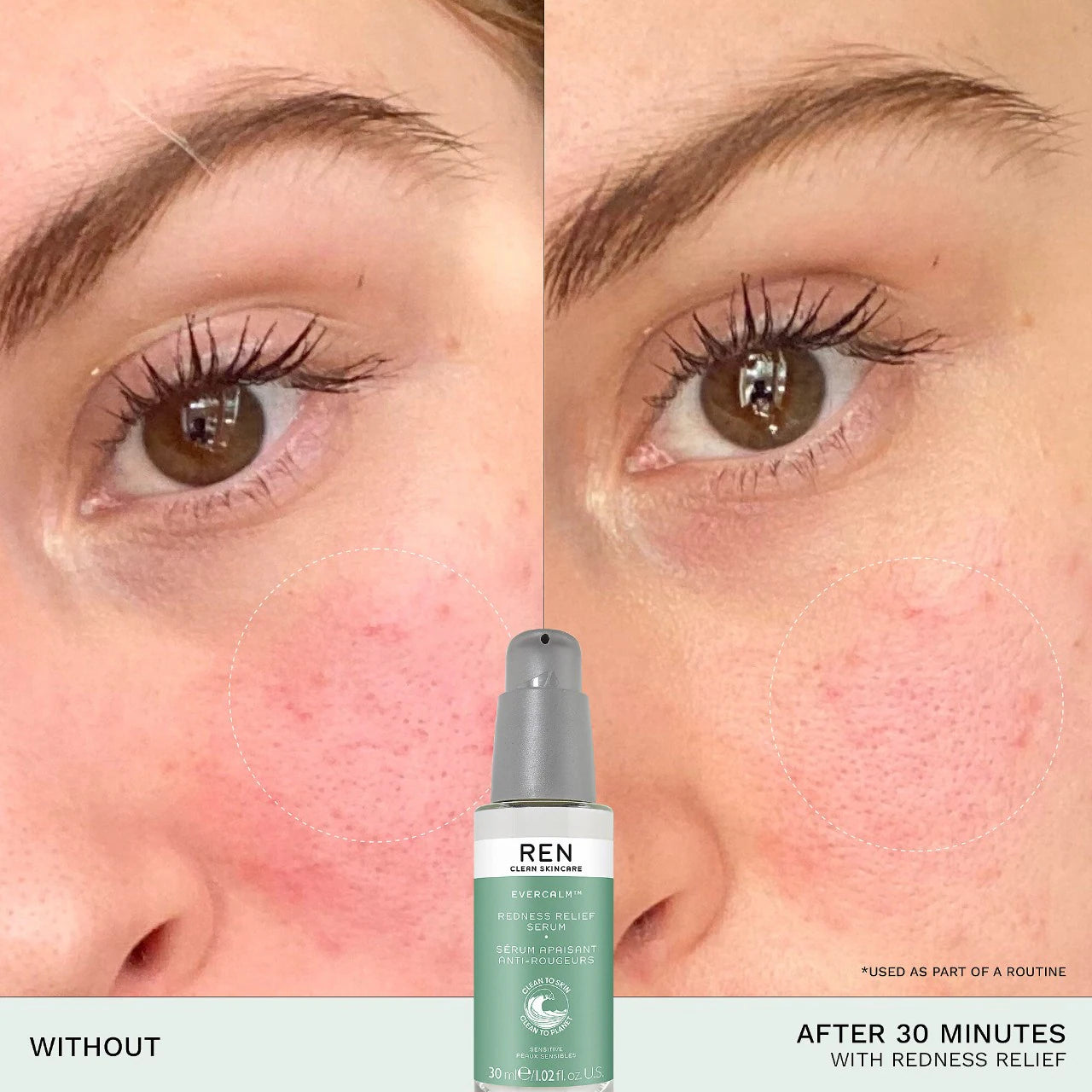 REN Clean Skincare Evercalm™ Redness Relief Serum 30ml - Soothing Facial Treatment for Sensitive Skin | Reduce Redness & Calm Irritation | Perfect for Rosacea & Post-Procedure Care
