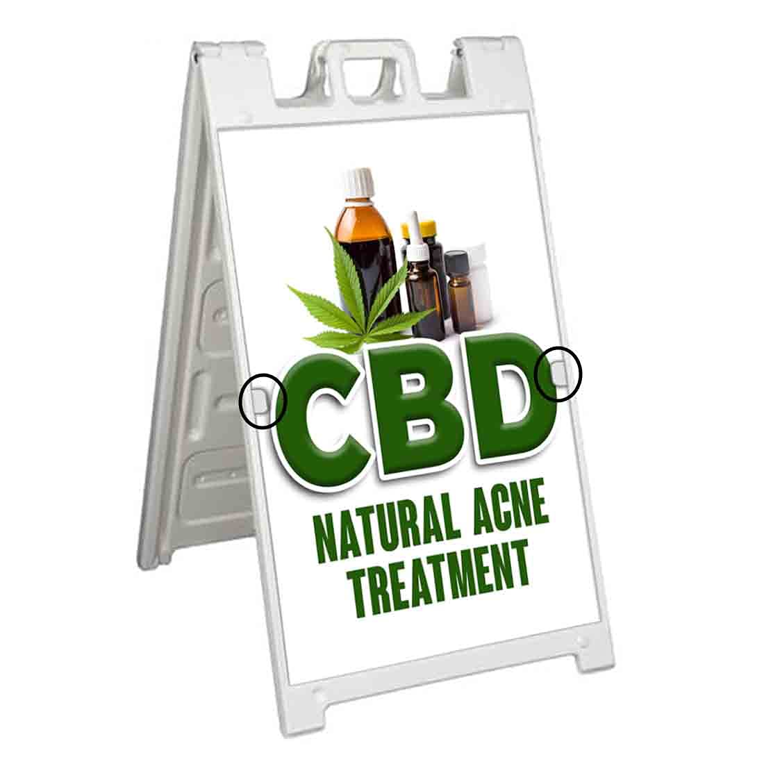 Premium CBD Oil for Natural Acne Treatment - 24