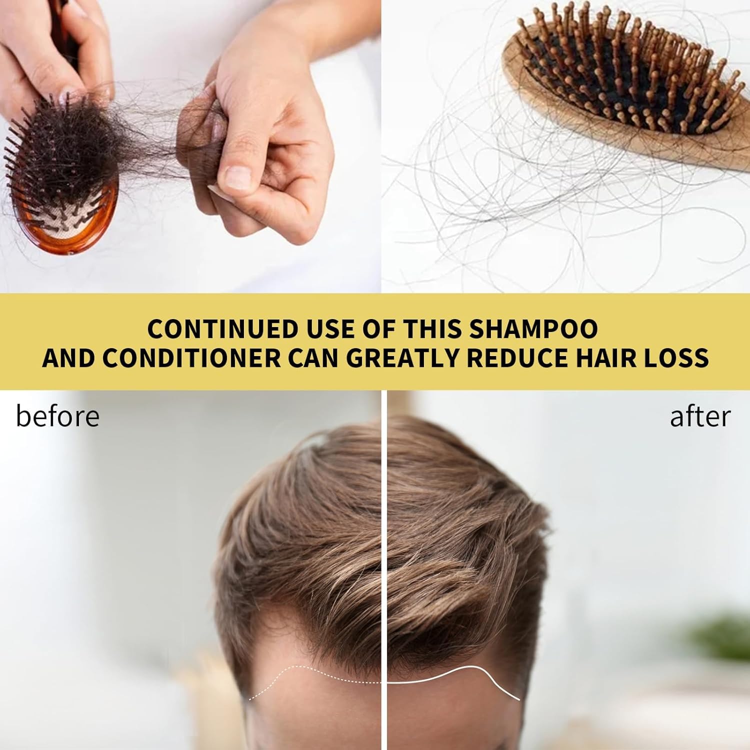 Ginger Hair Growth Shampoo for Thinning Hair & Hair Loss - Natural Thickening Shampoo with Ginger Extract to Stimulate Growth, Repair Damage & Add Shine (8.5 fl oz) - Perfect for Daily Use & Scalp Care Routine