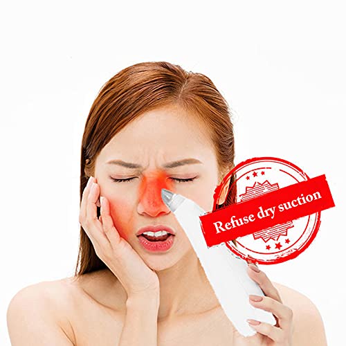 Professional Blackhead Remover Vacuum - Electric Pore Cleaner with 3 Speed Settings, Rechargeable & Portable for Deep Facial Cleansing - Perfect for Acne Treatment and Skincare Routine at Home