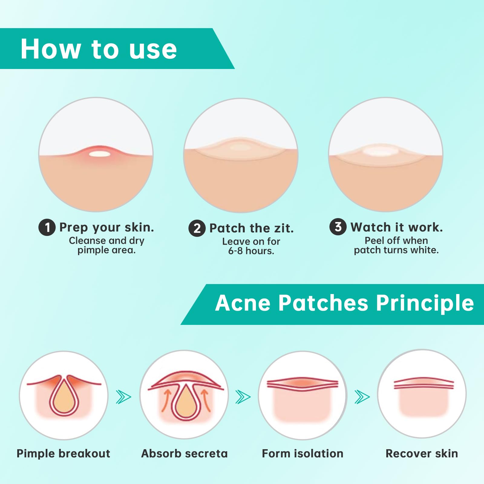 Hydrocolloid Acne Patches for Face - 210 Count Pimple Patches in 4 Sizes, Absorbs Fluid & Treats Zits, Blemishes & Breakouts | Perfect for Overnight Spot Treatment & Daily Acne Care