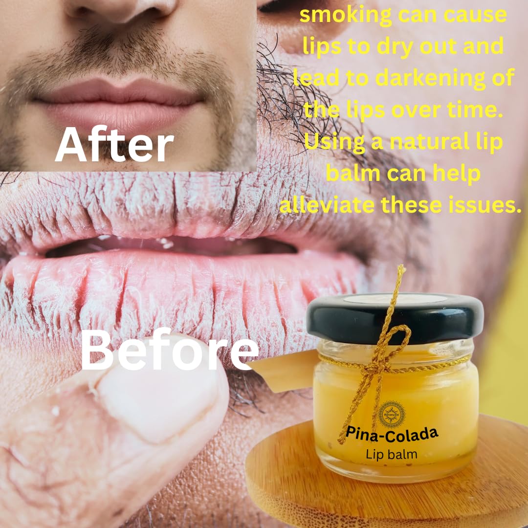 Organic Vegan Pina Colada Lip Balm for Extreme Hydration - Moisturizing Lip Care for Men, Women, Boys & Girls - 25g Glass Jar - Perfect for Dry Lips, Winter Care & On-the-Go Moisturizing