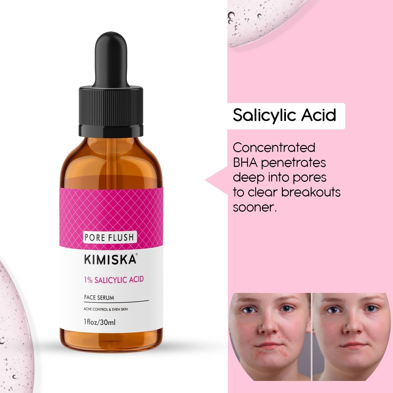 Acid Face Serum 30ml - Anti-Aging Wrinkle Treatment for Women - Hydrating Moisturizer to Reduce Fine Lines & Wrinkles - Fast Absorbing Facial Serum for Daily Skincare Routine | Perfect for Night Use & Dry Skin Care