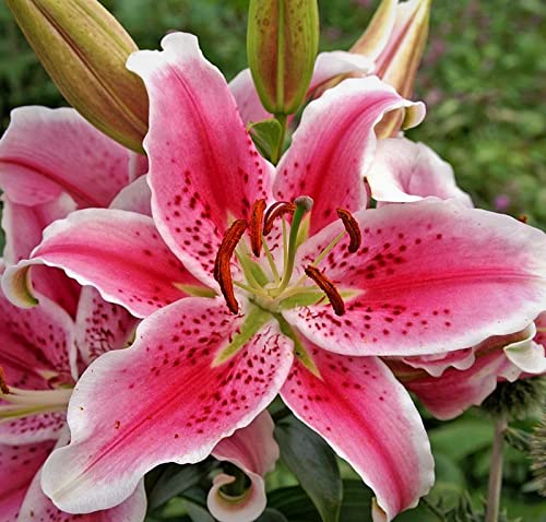 20 Stargazer Lily Bulbs - Large Fragrant Flowers for Garden Planting | Perfect for Bouquets, Weddings & Home Decor