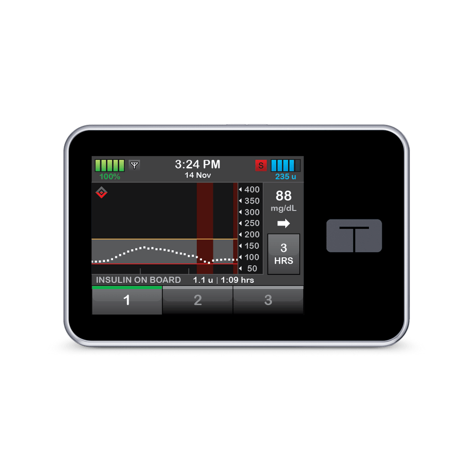 Digital Basal/Bolus Insulin Delivery Device for Diabetes Management - Portable & Precise Glucose Control for Home & Travel Use