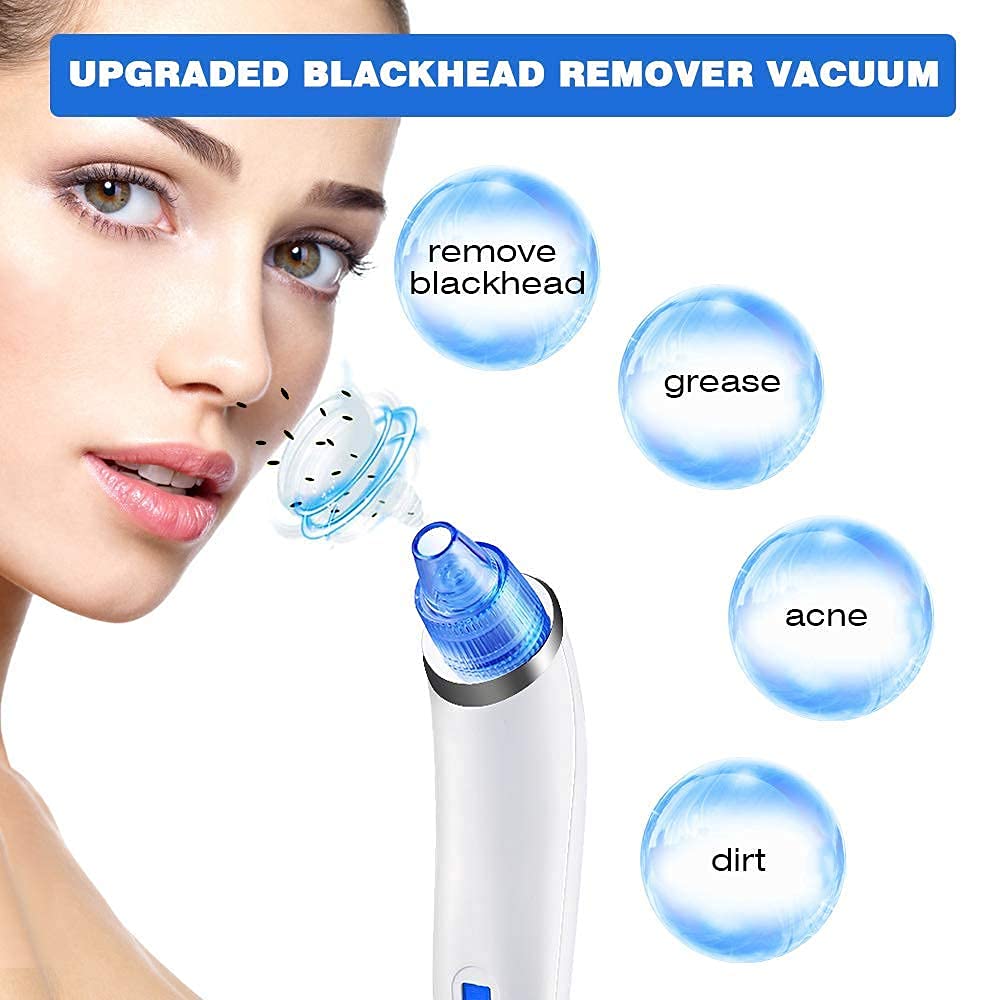 Ronest 4-in-1 Blackhead & Whitehead Remover Vacuum Tool - Acne Pimple Pore Cleaner for Men & Women | Gentle Skin Care Device for Face & Nose | Perfect for Daily Cleansing & Spa Treatments