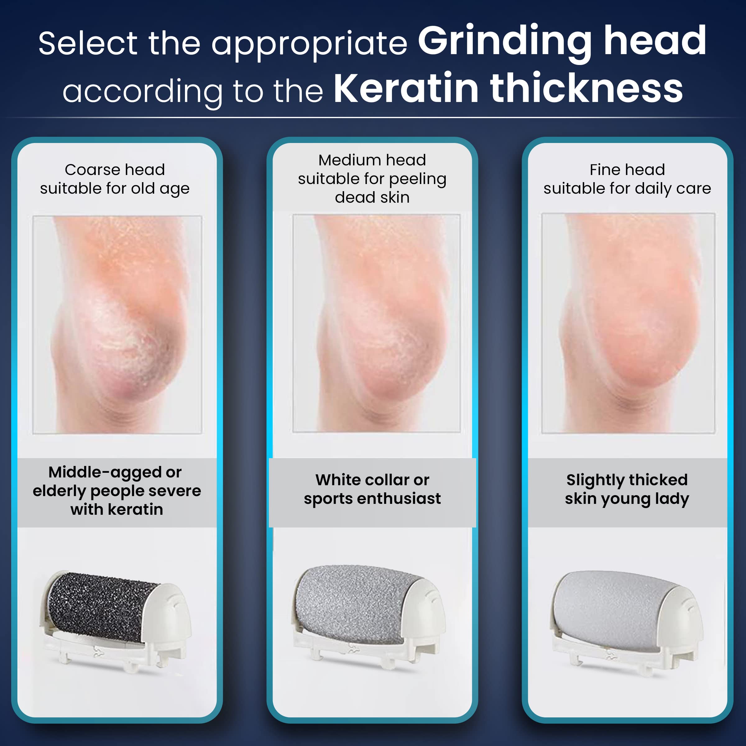 Agaro Electric Callus Remover with 3 Replaceable Heads - Professional Foot File for Dead Skin & Hard Callus Removal - Perfect for At-Home Pedicure & Foot Care Routine