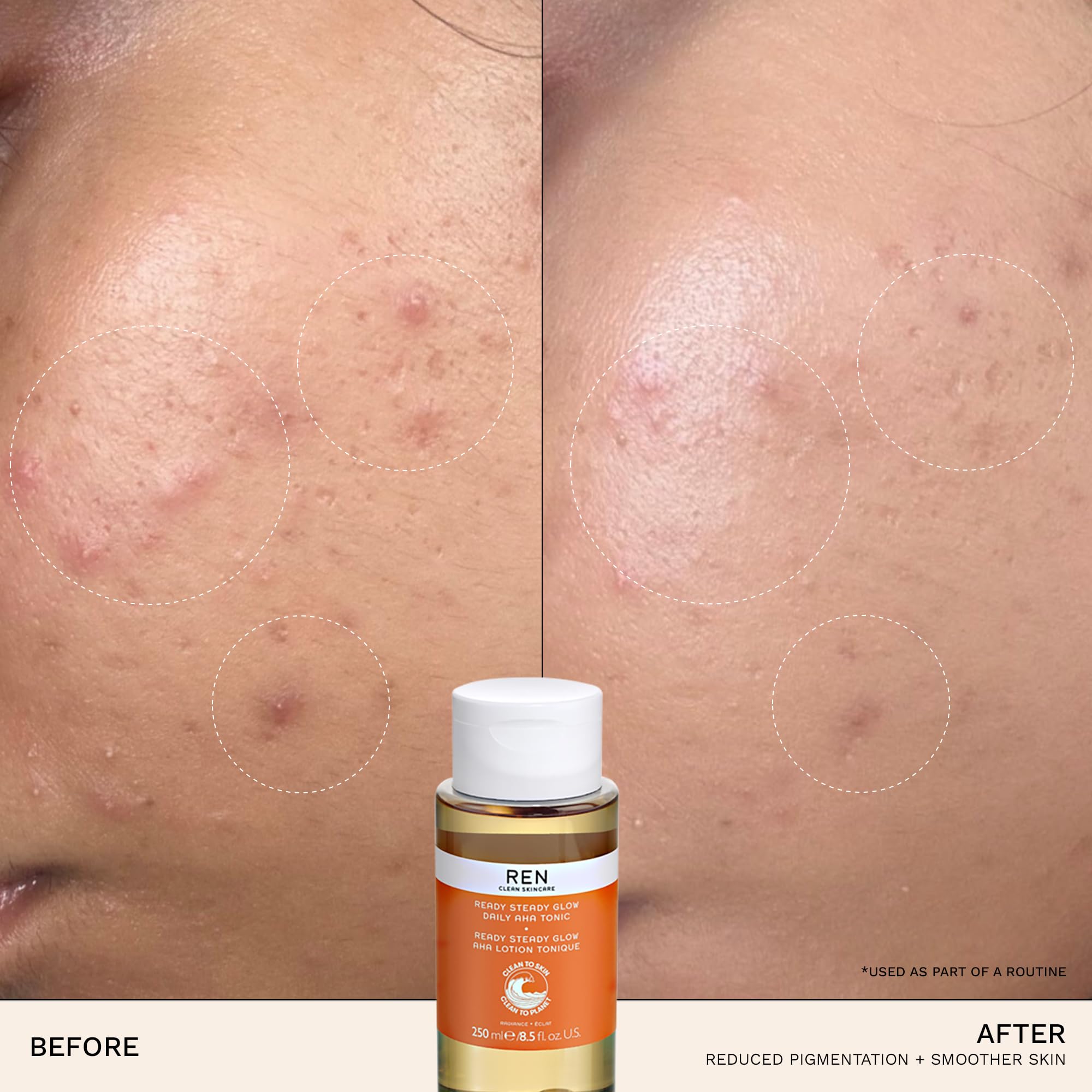 REN Clean Skincare Glow Tonic - Vegan Pore Minimizing Toner with AHAs & BHAs for Exfoliation | Brightens Skin, Reduces Pores & Evens Tone | Daily Facial Treatment for Glowing Complexion | Perfect for Morning & Night Skincare Routine