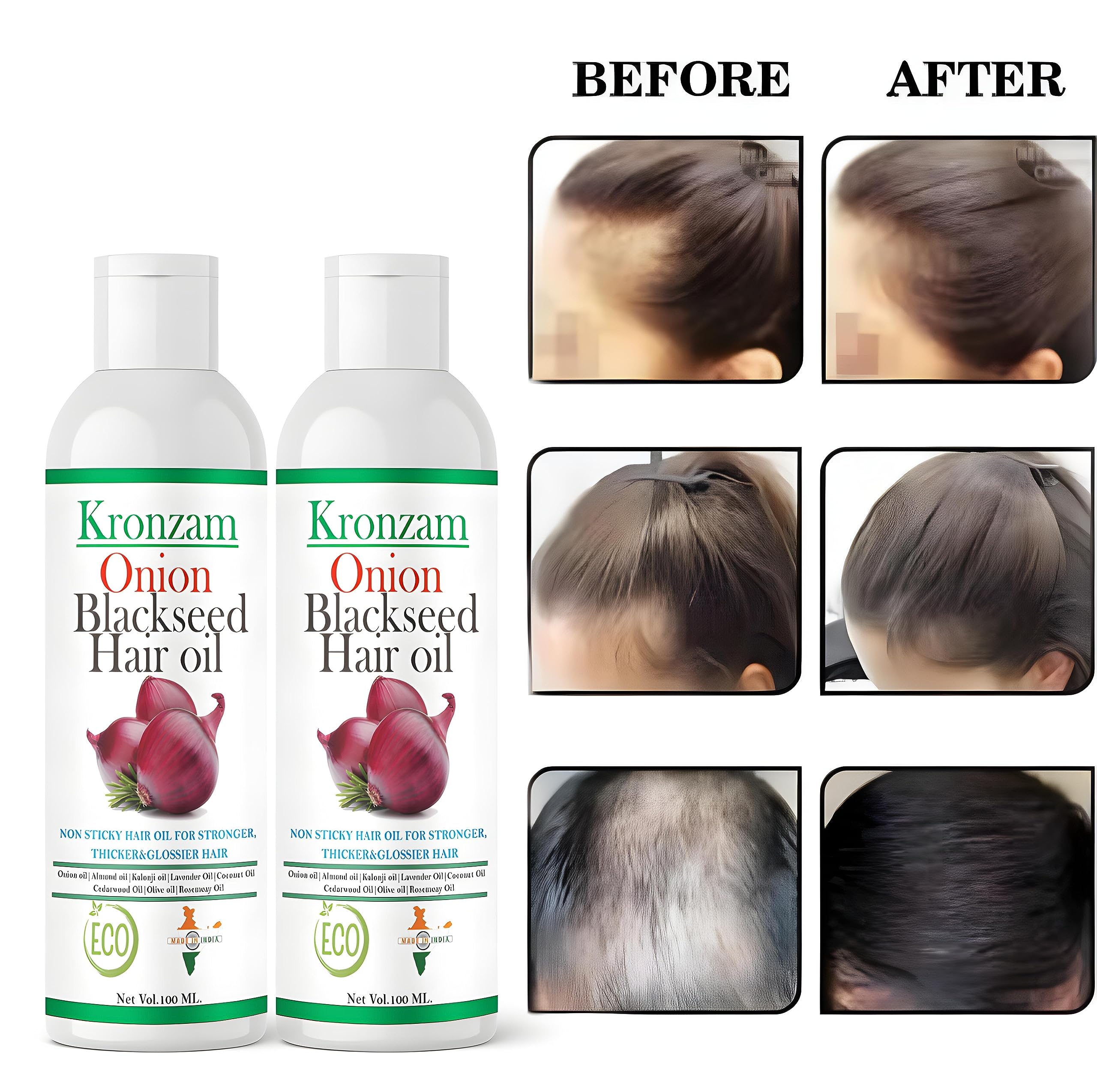 Advanced Black Seed Onion Hair Oil for Hair Growth & Hair Fall Control - No Mineral Oil - Pack of 2 - Promotes Thicker, Stronger Hair for Men & Women - Perfect for Daily Scalp Massage & Damaged Hair Care