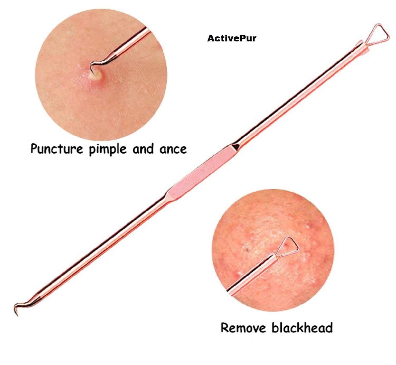 Professional Blackhead & Pimple Remover Kit - 4-Piece Acne Extractor Tool for Whitehead & Comedone Removal | Safe for Face, Nose & Skin | Includes Travel Case | Perfect for Home Skincare & Spa Treatments
