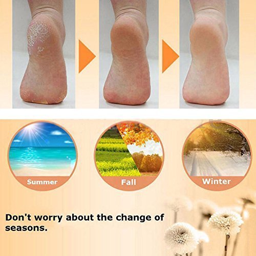 Dweezhet Anti Crack Silicone Foot Protector Socks - Moisturizing Heel Pads for Cracked Feet & Pain Relief - One Size Fits All Men & Women - Perfect for Dry Skin Care, Overnight Treatment & Diabetic Foot Comfort