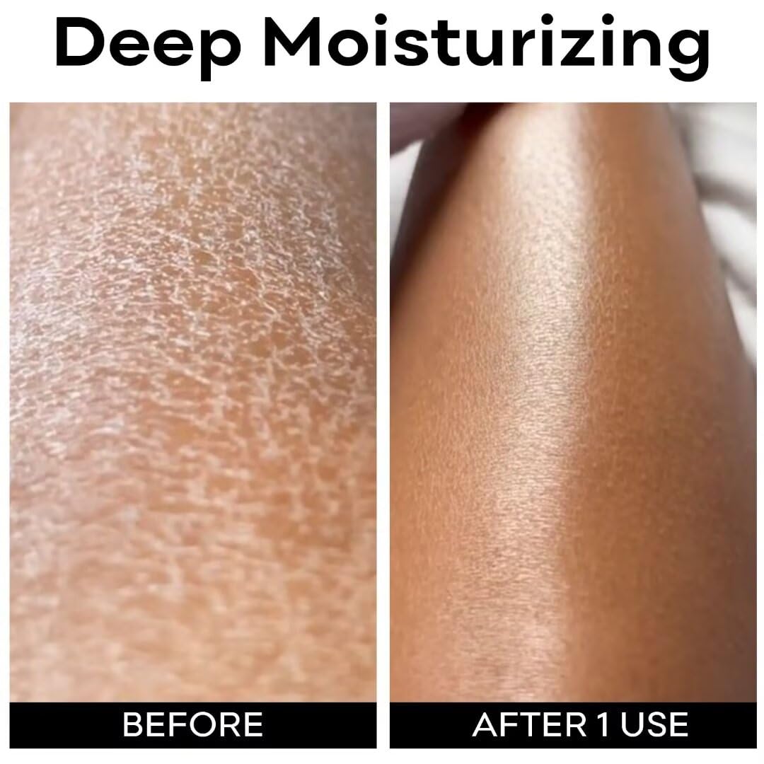 Deep Hydrating Hyaluronic Acid Body Lotion for Dry & Sensitive Skin - Non-Greasy Face & Body Moisturizer with Long-Lasting Moisture - 7.05 Oz | Perfect for Daily Skincare Routine & Winter Skin Care