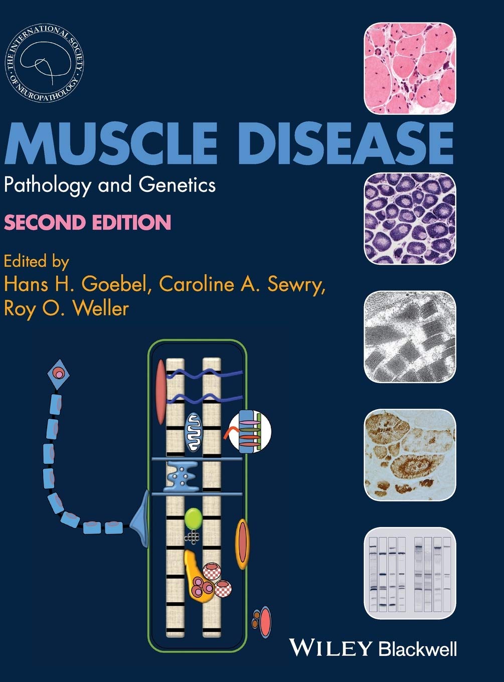 Muscle Disease: Pathology, Genetics & Treatment - Comprehensive Guide for Medical Professionals & Researchers
