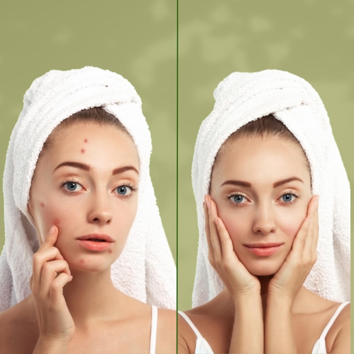 VeloxVeda Tea Tree Face Wash 100ml - Natural Anti-Acne Cleanser for Oily & Acne-Prone Skin | Paraben-Free, Sulfate-Free Formula with Turmeric, Curry Leaves & Tea Tree Oil | Gentle Daily Facial Cleanser for Men & Women | Perfect for Morning & Night Skincare Routine